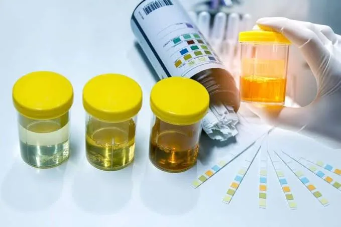 What Your Pee Says About Your Health (And Why You Should Listen)