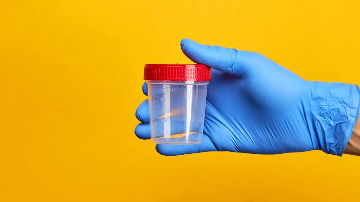Stool Tests: What Your Gut Can Reveal About Your Health