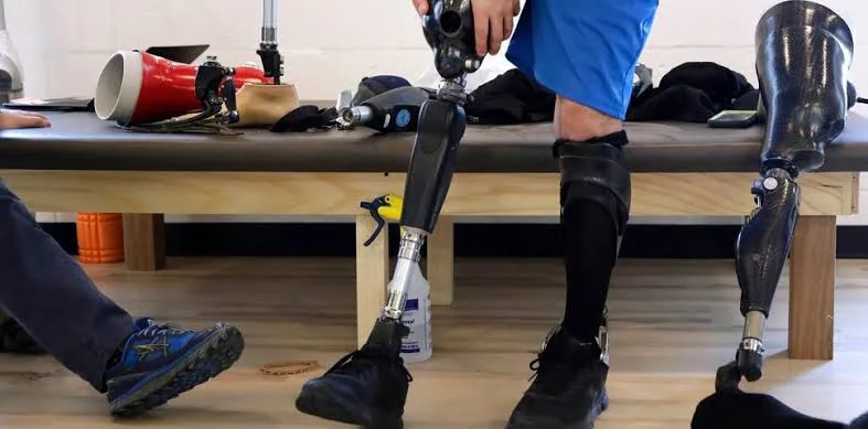 Prosthetics & Orthotics: Enhancing Mobility and Function