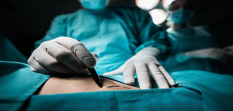 Mastectomy: What to Expect Before, During, and After Surgery