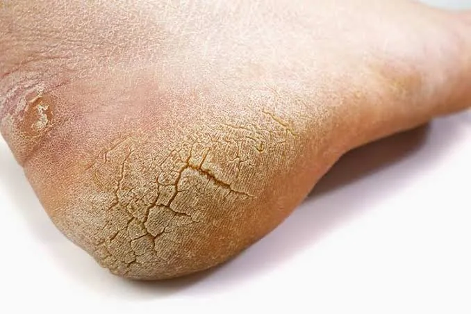 12 Unusual Signs That May Indicate Your Liver is at Risk
