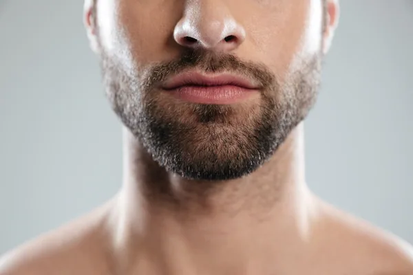 Beard Transplants Explained: The Permanent Solution to a Thicker Beard