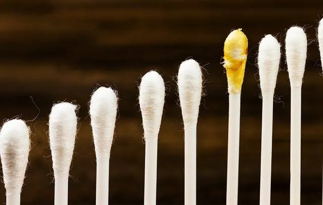 Why Cleaning Your Ears with Cotton Swabs Can Be Dangerous