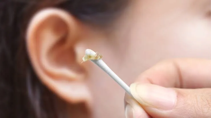 Why Cleaning Your Ears with Cotton Swabs Can Be Dangerous