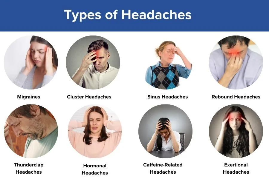 Types of Headaches by Location: Causes and How to Treat Them