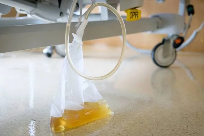Is Urine Really Sterile? The Science Behind This Common Health Myth