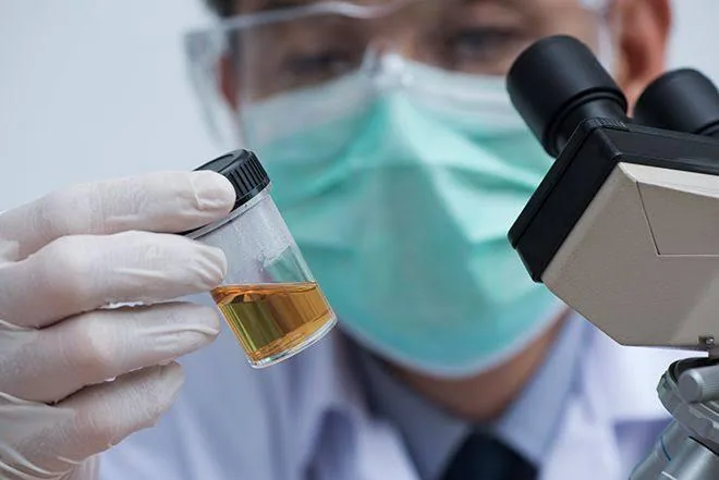 Is Urine Really Sterile? The Science Behind This Common Health Myth