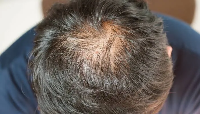 The One Mistake Ruining Your Hair Growth They Don't Want You To Know This
