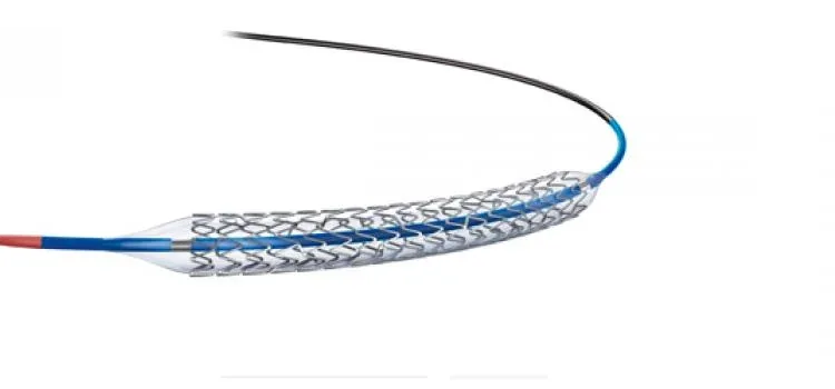 Mastering Stents: A Comprehensive Guide to Types, Placement, and Medical Applications