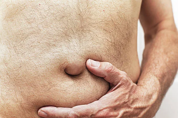 Common Mistakes People Make That Allow a Small Hernia to Grow Rapidly